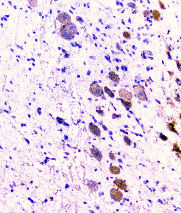 2 - Anti-CD2AP Antibody Picoband™ (monoclonal, 5F8) ABO14802