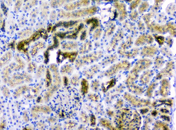 2 - Anti-CD2AP Antibody Picoband™ (monoclonal, 5F8) ABO14802