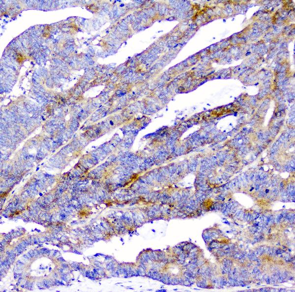 2 - Anti-CD2AP Antibody Picoband™ (monoclonal, 5F8) ABO14802