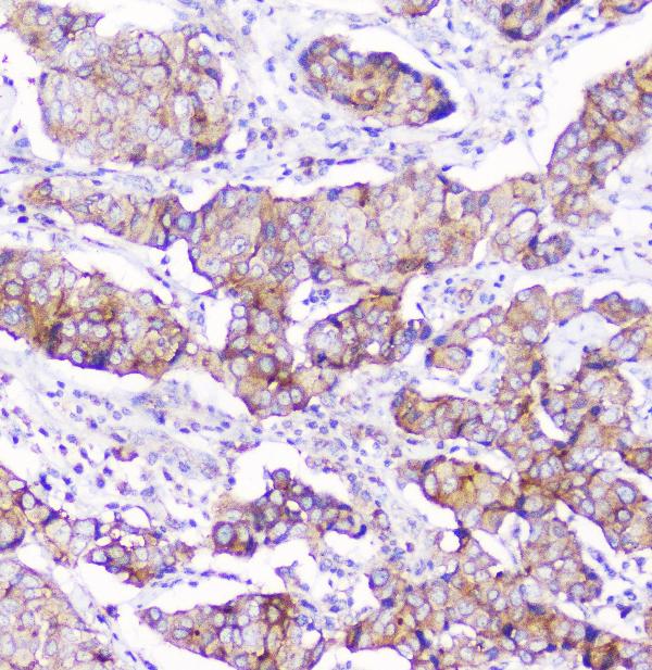 2 - Anti-CD2AP Antibody Picoband™ (monoclonal, 5F8) ABO14802