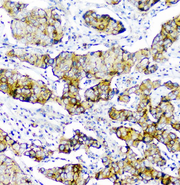 2 - Anti-CD2AP Antibody Picoband™ (monoclonal, 5F8) ABO14802