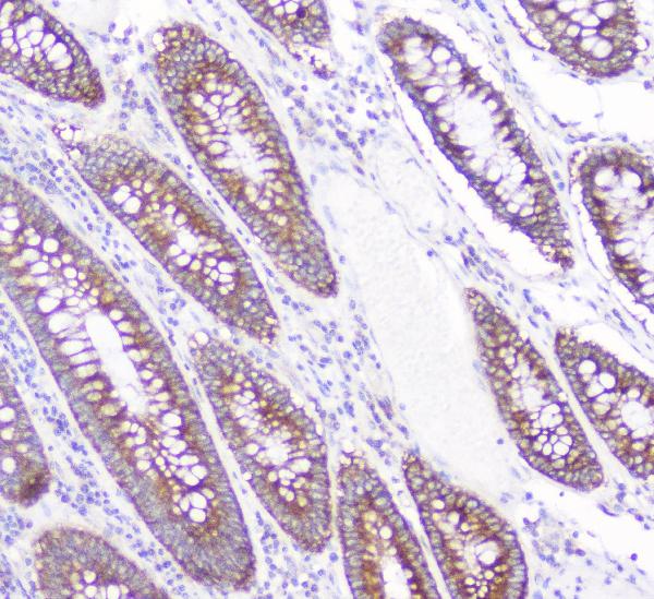 2 - Anti-CD2AP Antibody Picoband™ (monoclonal, 5F8) ABO14802