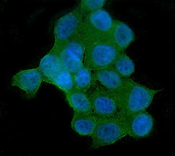 3 - Anti-AKT2 Antibody Picoband™ (monoclonal, 10C6) ABO14804