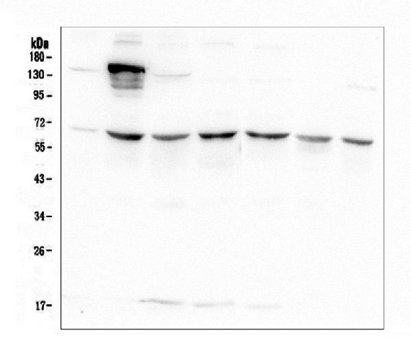 1 - Anti-AKT2 Antibody Picoband™ (monoclonal, 10C6) ABO14804