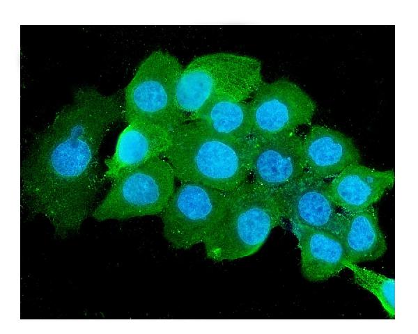 3 - Anti-Beta 2 Microglobulin B2M Antibody Picoband™ (monoclonal, 2H10) ABO14818
