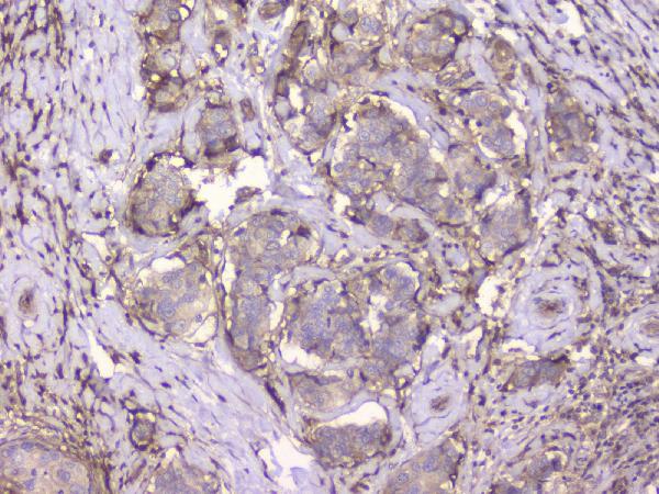 2 - Anti-Beta 2 Microglobulin B2M Antibody Picoband™ (monoclonal, 2H10) ABO14818