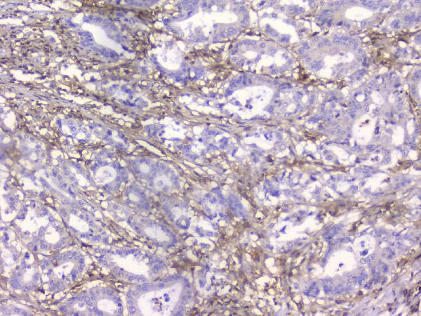 2 - Anti-Beta 2 Microglobulin B2M Antibody Picoband™ (monoclonal, 2H10) ABO14818