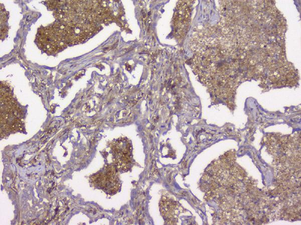 2 - Anti-Beta 2 Microglobulin B2M Antibody Picoband™ (monoclonal, 2H10) ABO14818