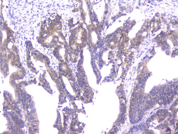 2 - Anti-PPID Antibody Picoband™ (monoclonal, 5A6) ABO14819