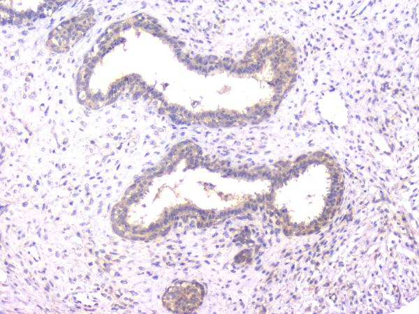 2 - Anti-PPID Antibody Picoband™ (monoclonal, 5A6) ABO14819