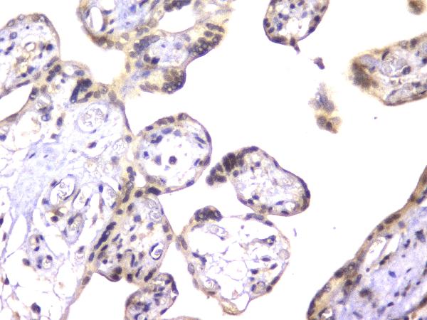 2 - Anti-EWSR1 Antibody Picoband™ (monoclonal, 4B4) ABO14820