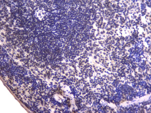 2 - Anti-EWSR1 Antibody Picoband™ (monoclonal, 4B4) ABO14820