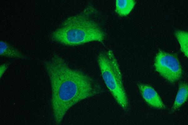 3 - Anti-Calpain 2 CAPN2 Antibody Picoband™ (monoclonal, 8I6) ABO14821