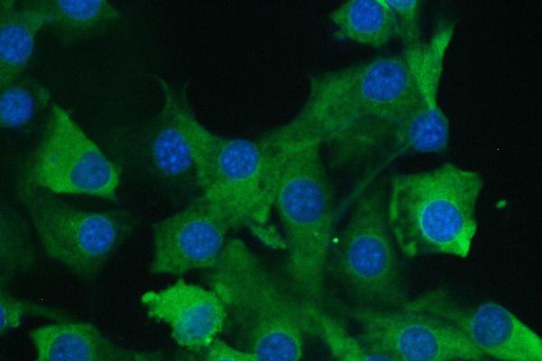 3 - Anti-Calpain 2 CAPN2 Antibody Picoband™ (monoclonal, 8I6) ABO14821