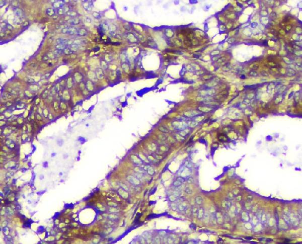 2 - Anti-Calpain 2 CAPN2 Antibody Picoband™ (monoclonal, 8I6) ABO14821
