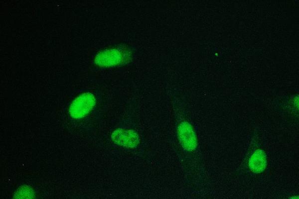 3 - Anti-RPA70 RPA1 Antibody Picoband™ (monoclonal, 11H4) ABO14822
