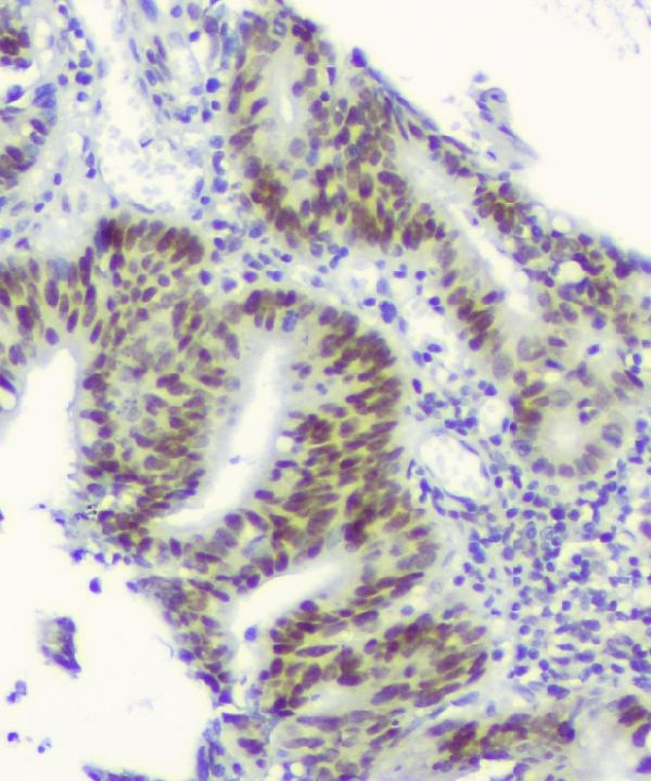 2 - Anti-RPA70 RPA1 Antibody Picoband™ (monoclonal, 11H4) ABO14822
