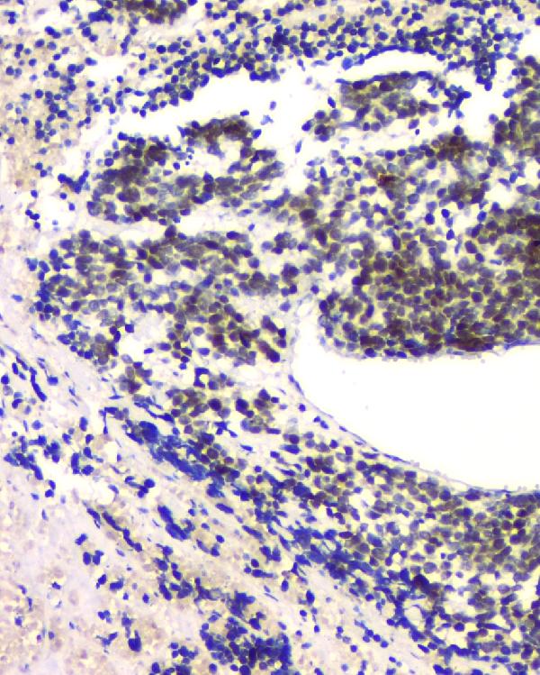 2 - Anti-RPA70 RPA1 Antibody Picoband™ (monoclonal, 11H4) ABO14822