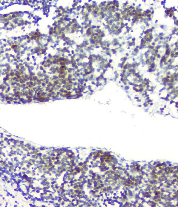 2 - Anti-RPA70 RPA1 Antibody Picoband™ (monoclonal, 11H4) ABO14822