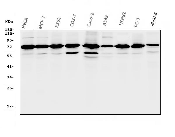 1 - Anti-RPA70 RPA1 Antibody Picoband™ (monoclonal, 11H4) ABO14822