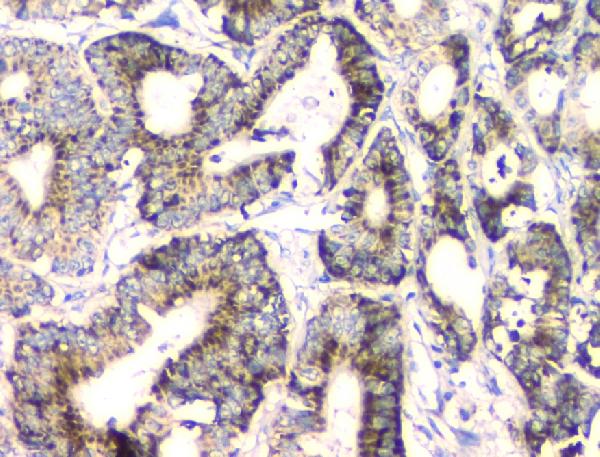 2 - Anti-FH Antibody Picoband™ (monoclonal, 9D8) ABO14823