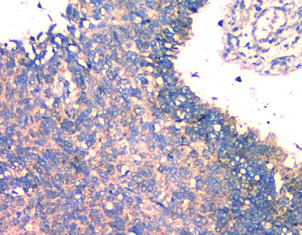 2 - Anti-FH Antibody Picoband™ (monoclonal, 9D8) ABO14823