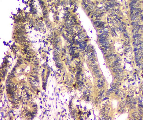 2 - Anti-SHP2/PTPN11 Antibody Picoband™ (monoclonal, 2E6) ABO14824