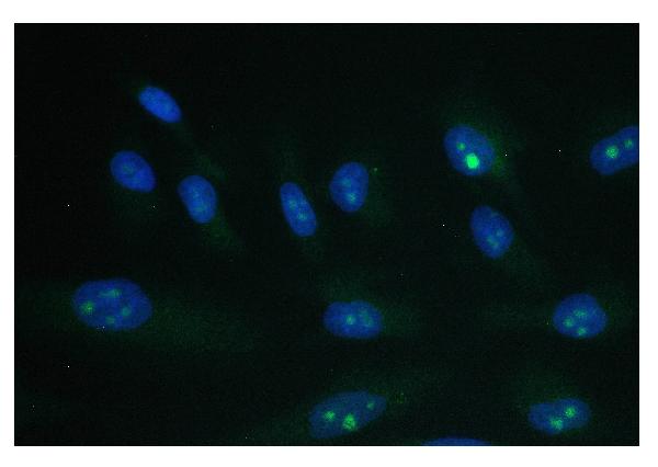 3 - Anti-PARN Antibody Picoband™ (monoclonal, 11D8) ABO14826