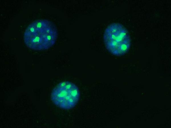 3 - Anti-PARN Antibody Picoband™ (monoclonal, 11D8) ABO14826