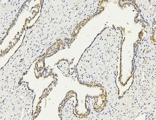 2 - Anti-PARN Antibody Picoband™ (monoclonal, 11D8) ABO14826