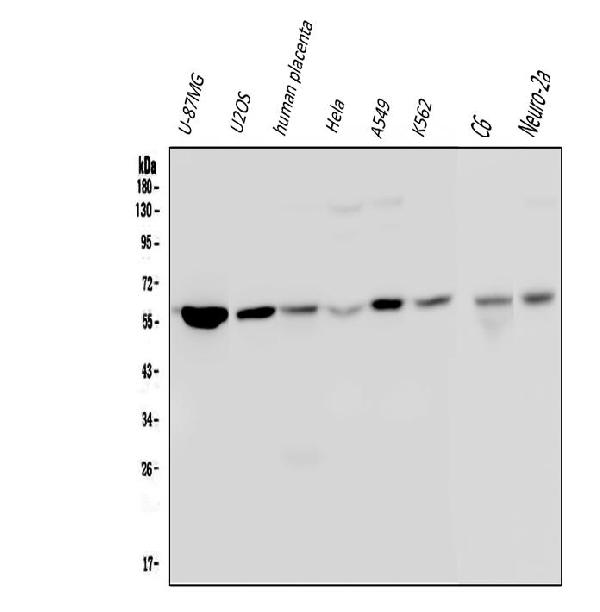 1 - Anti-Optineurin/OPTN Antibody Picoband™ (monoclonal, 3D8) ABO14827