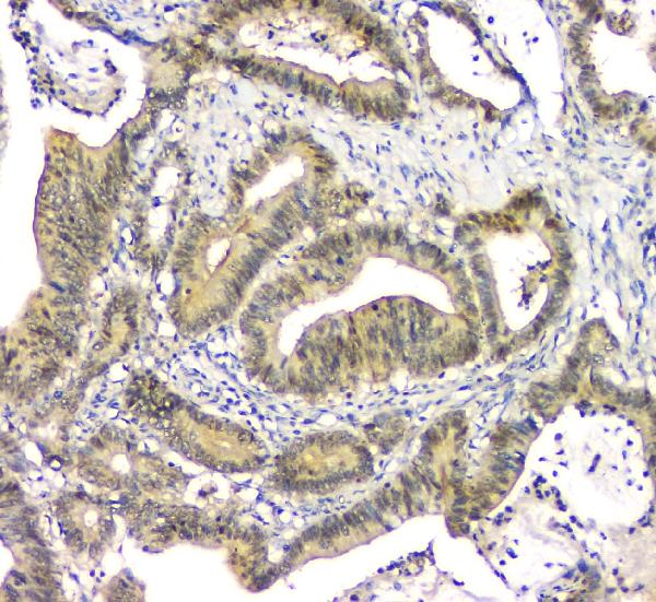 2 - Anti-EIF6 Antibody Picoband™ (monoclonal, 2I11) ABO14828