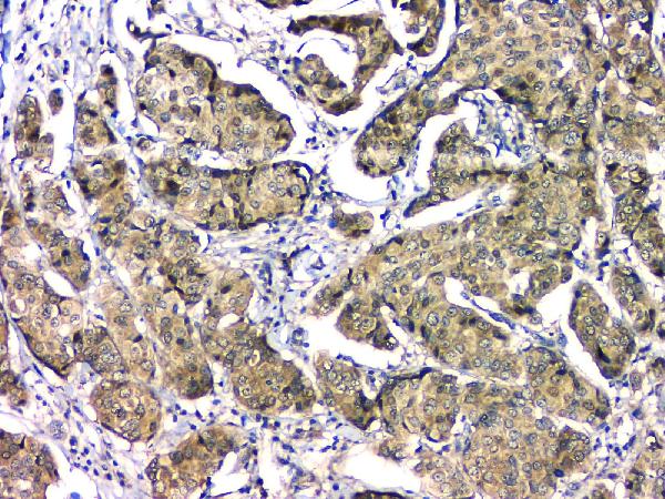 2 - Anti-EIF6 Antibody Picoband™ (monoclonal, 2I11) ABO14828