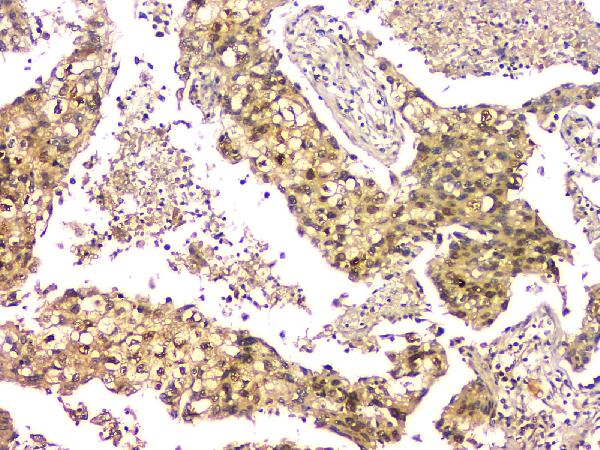 2 - Anti-EIF6 Antibody Picoband™ (monoclonal, 2I11) ABO14828
