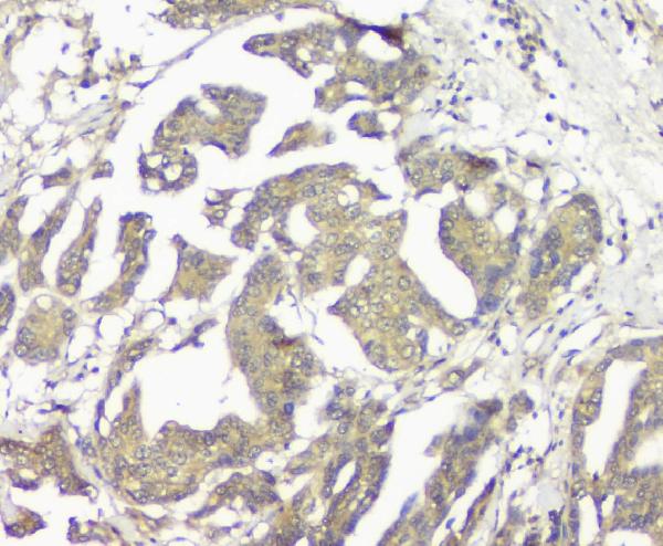 2 - Anti-GNAQ Antibody Picoband™ (monoclonal, 13H4) ABO14829