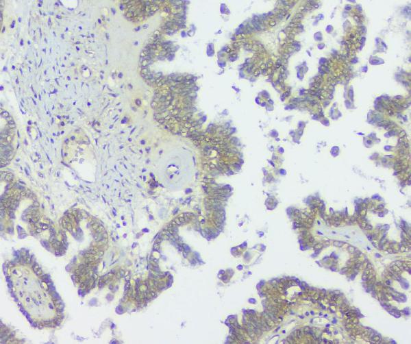 2 - Anti-GNAQ Antibody Picoband™ (monoclonal, 13H4) ABO14829