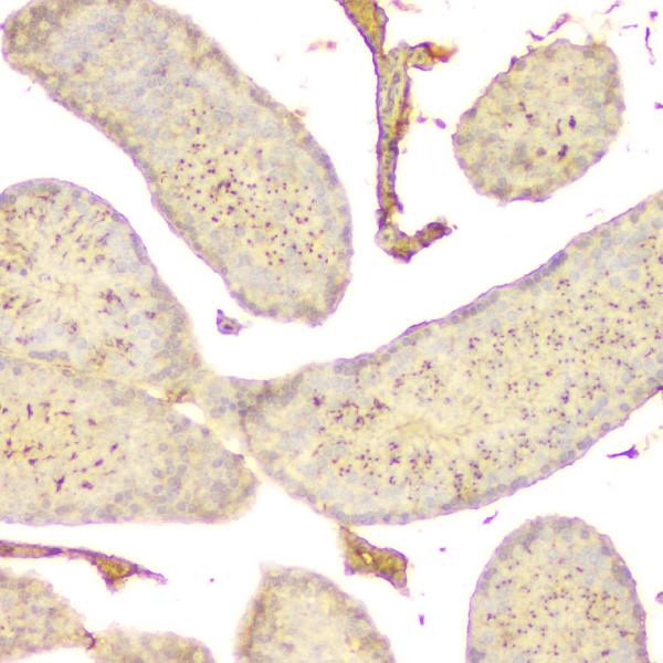 2 - Anti-GNAQ Antibody Picoband™ (monoclonal, 13H4) ABO14829