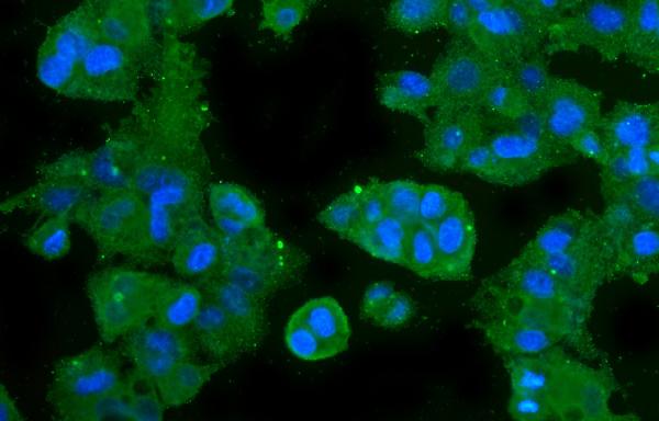 3 - Anti-CA2 Antibody Picoband™ (monoclonal, 10E11) ABO14830