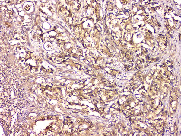 2 - Anti-CA2 Antibody Picoband™ (monoclonal, 10E11) ABO14830