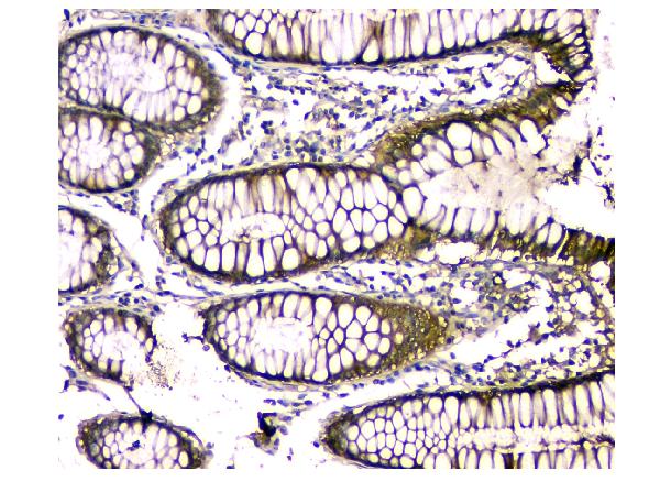 2 - Anti-CA2 Antibody Picoband™ (monoclonal, 10E11) ABO14830
