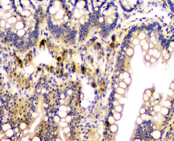 2 - Anti-CA2 Antibody Picoband™ (monoclonal, 10E11) ABO14830
