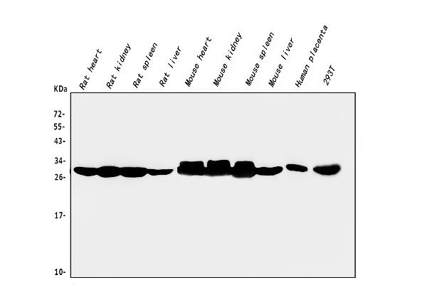 1 - Anti-CA2 Antibody Picoband™ (monoclonal, 10E11) ABO14830