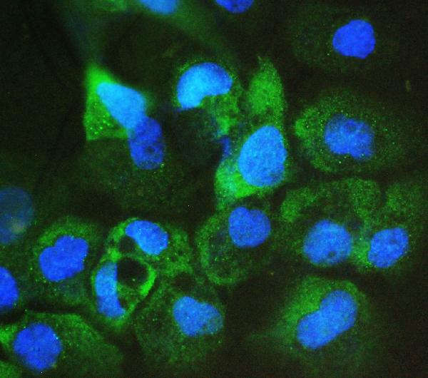 3 - Anti-ARA9/AIP Antibody Picoband™ (monoclonal, 10G8) ABO14831