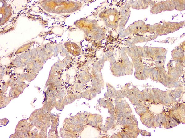 2 - Anti-ARA9/AIP Antibody Picoband™ (monoclonal, 10G8) ABO14831