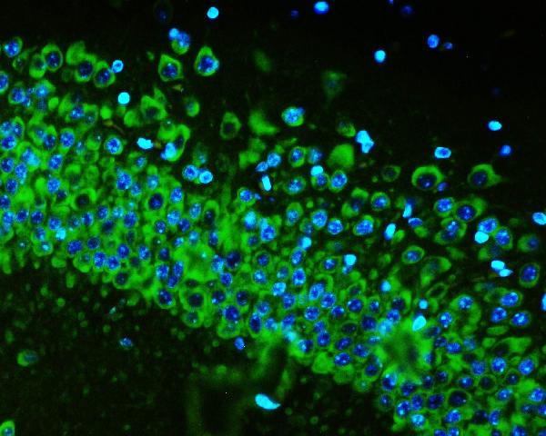 3 - Anti-RPS6 Antibody Picoband™ (monoclonal, 2H7) ABO14832