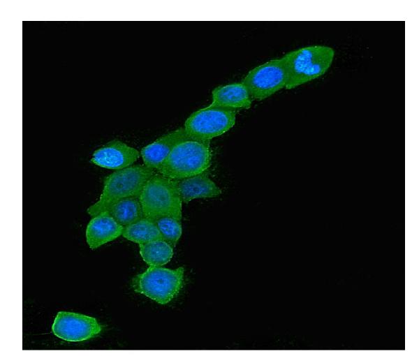3 - Anti-Rab5/RAB5A Antibody Picoband™ (monoclonal, 3E9) ABO14833