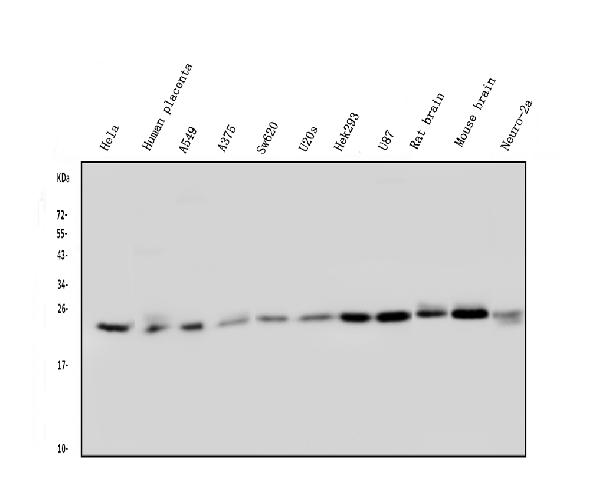 1 - Anti-Rab5/RAB5A Antibody Picoband™ (monoclonal, 3E9) ABO14833