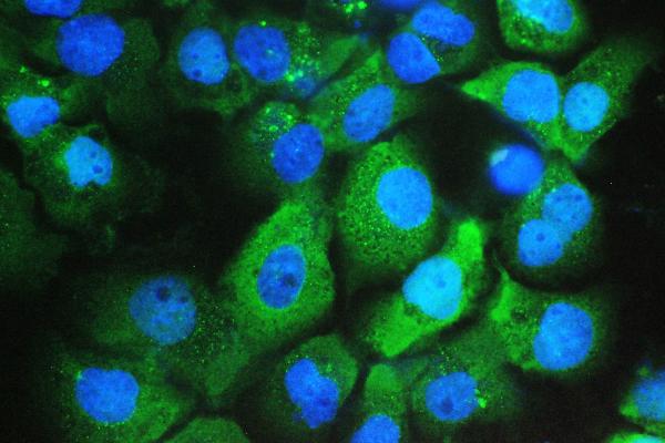 3 - Anti-Galectin 3/LGALS3 Antibody Picoband™ (monoclonal, 12B12) ABO14834