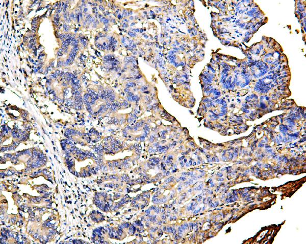 2 - Anti-Galectin 3/LGALS3 Antibody Picoband™ (monoclonal, 12B12) ABO14834