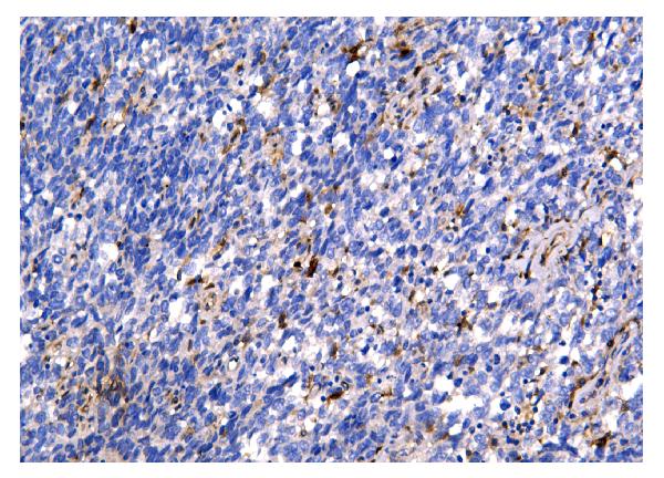 2 - Anti-Galectin 3/LGALS3 Antibody Picoband™ (monoclonal, 12B12) ABO14834